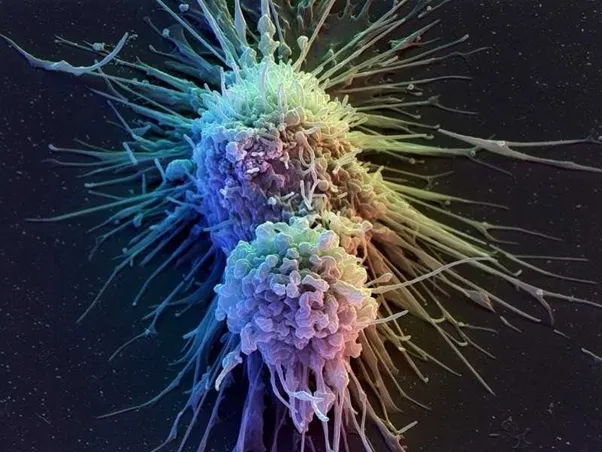 Bạn biết gì về liệu pháp tế bào CAR-T chưa?