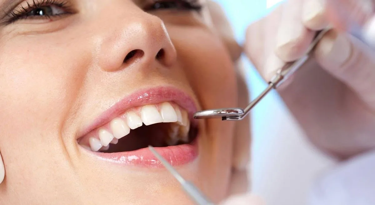 Niềng răng có phải nhổ răng không? Khi nào cần nhổ răng?