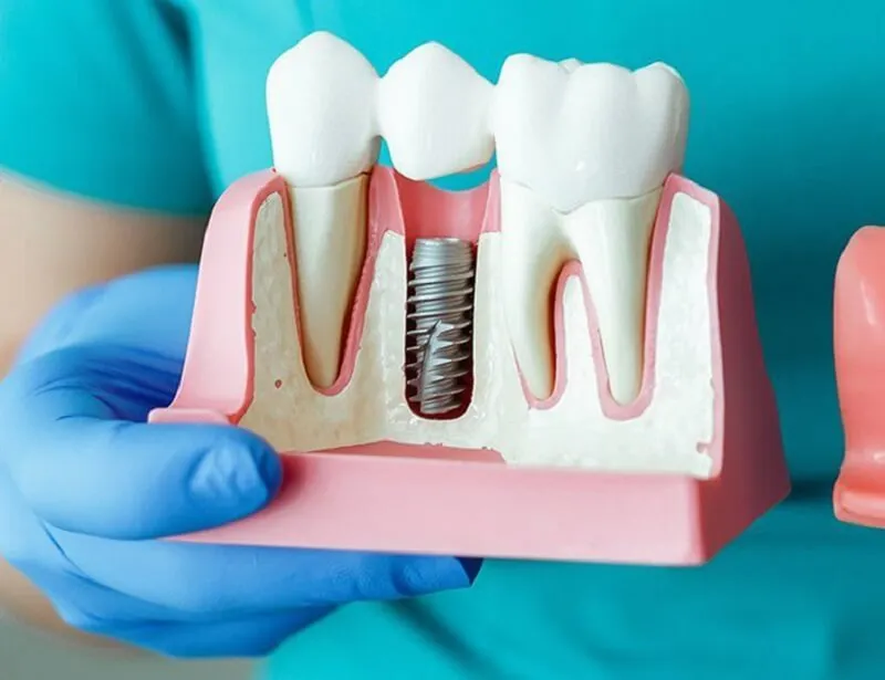 Trồng răng Implant cho người già có được không? Có an toàn không?
