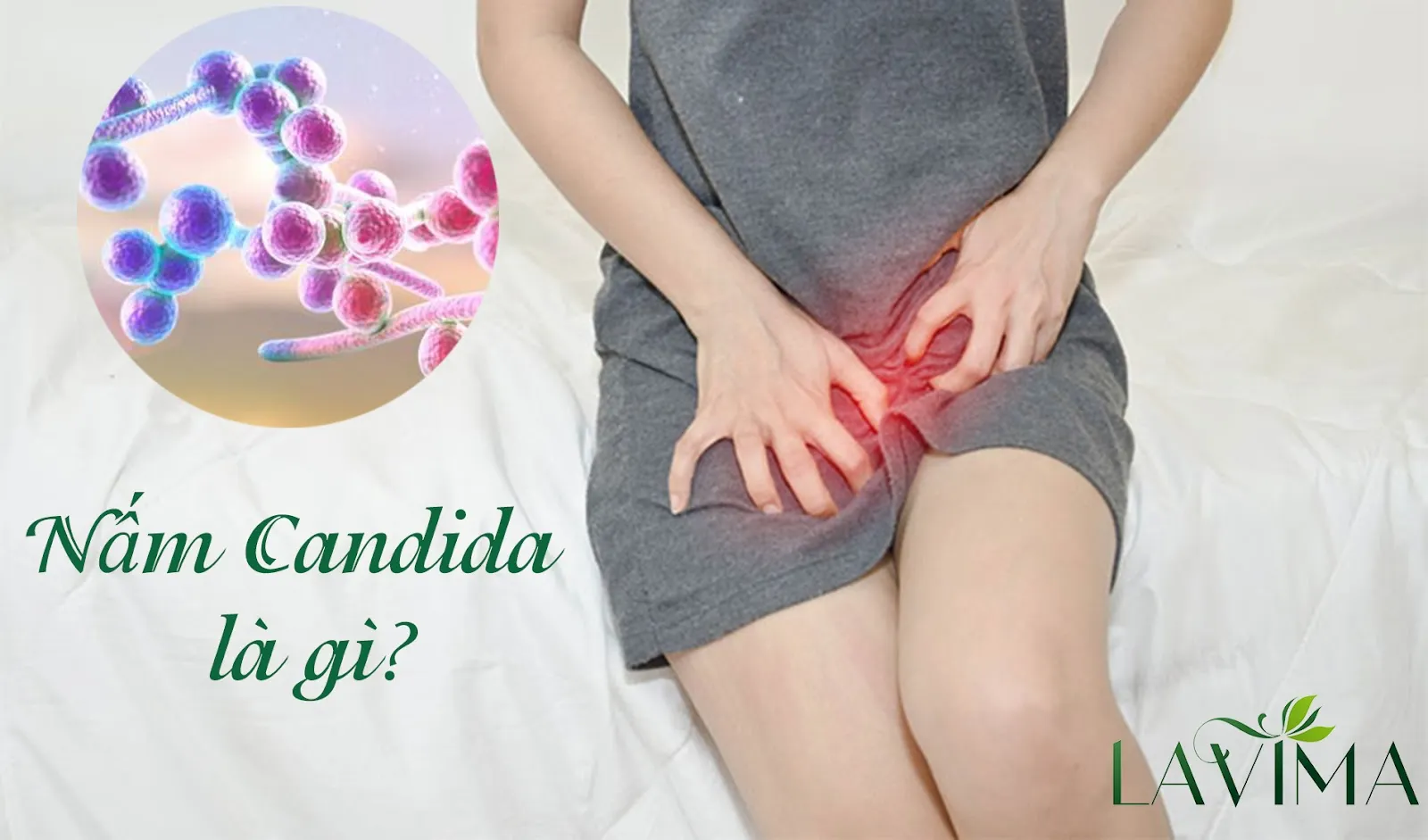 Bệnh nấm candida đường sinh dục là bệnh gì? Cách điều trị hiệu quả nhất hiện nay